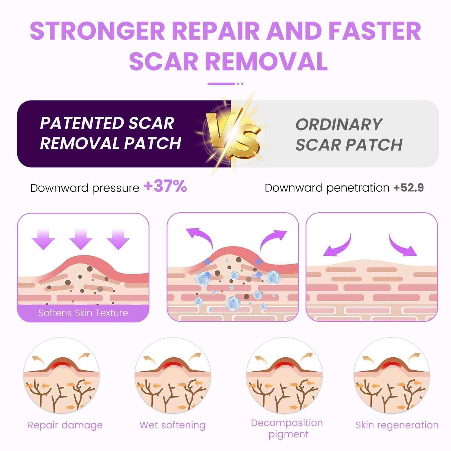 Nozibye Medical Grade Silicone Scar Sheets & Tape Roll for Keloids & Old Scars - Perforated Strips Every 6cm, No Scissors Needed | 4x300cm Large Roll | Reusable & Washable | Fades C-Section, Surgery, Burn, Acne Scars