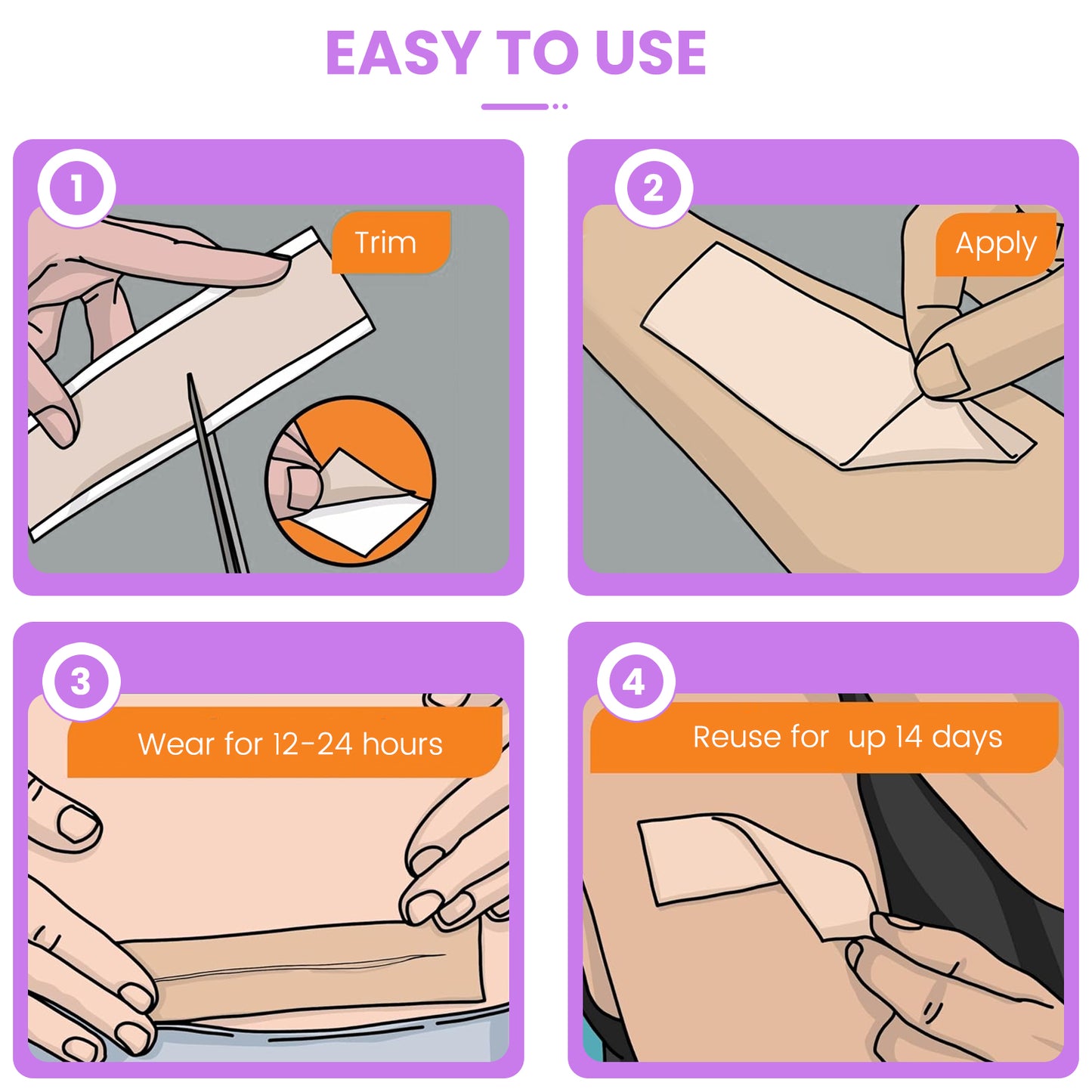 Nozibye Medical Grade Silicone Scar Sheets & Tape Roll for Keloids & Old Scars - Perforated Strips Every 6cm, No Scissors Needed | 4x300cm Large Roll | Reusable & Washable | Fades C-Section, Surgery, Burn, Acne Scars
